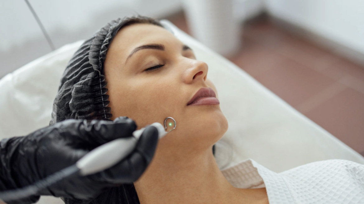 Acne Scar Laser Treatment Costs and Consultations in Arlington, Virginia